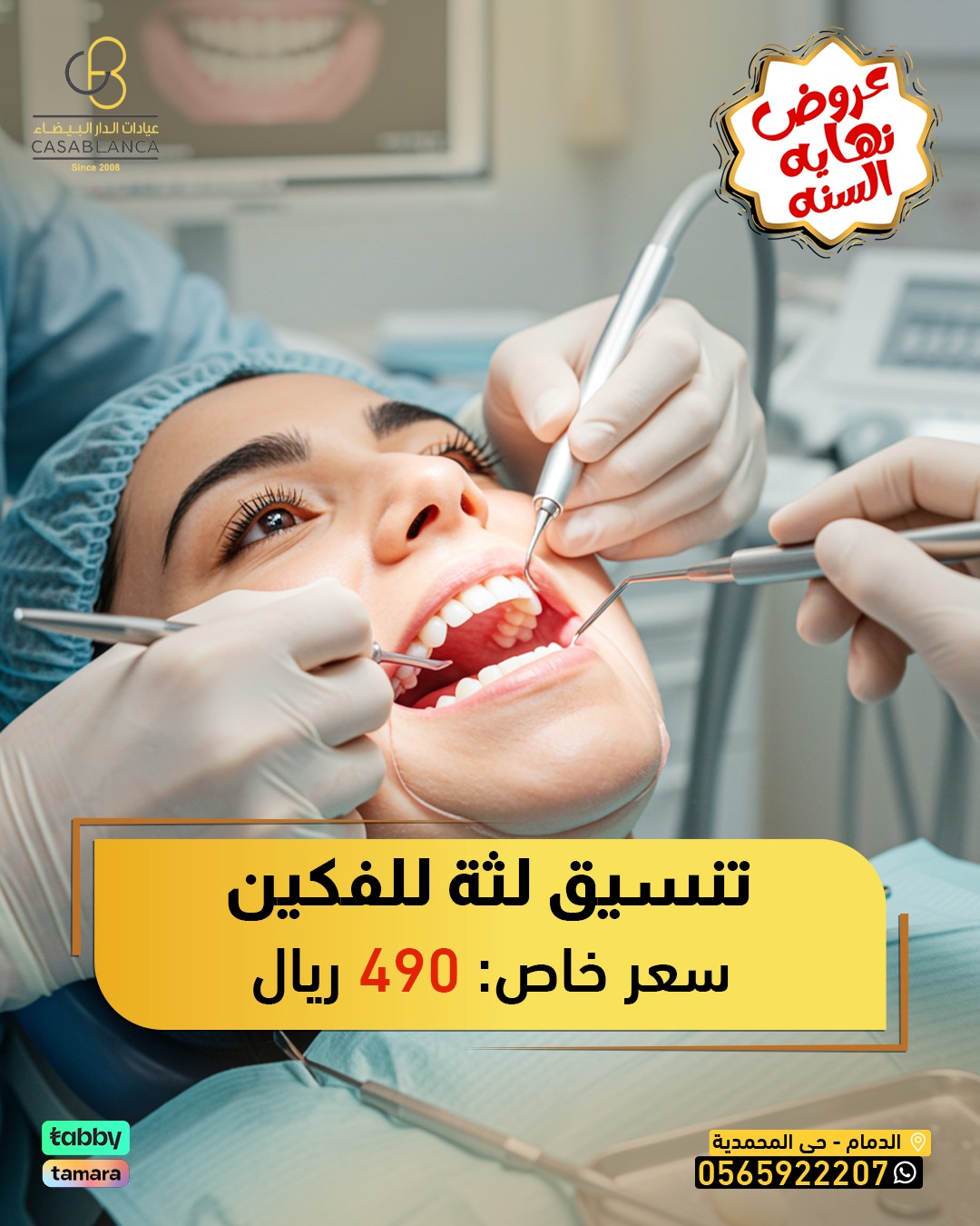 قص اللثة ( فكين ) 